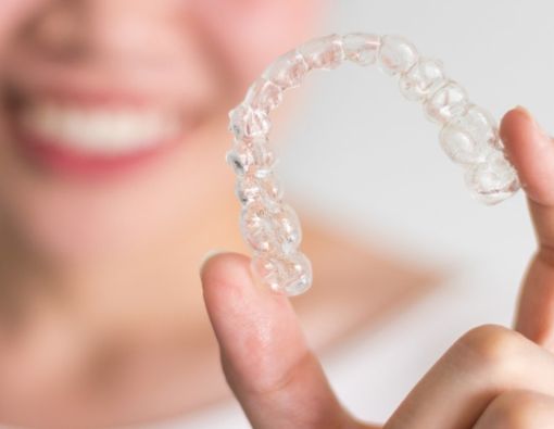 Berapa Lama Harus Pakai Behel Transparan agar Gigi Rata Maksimal?