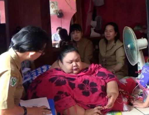 Wanita 350 kg di Kalteng, Obesitas Akibat Gemar Ngemil Gorengan?
