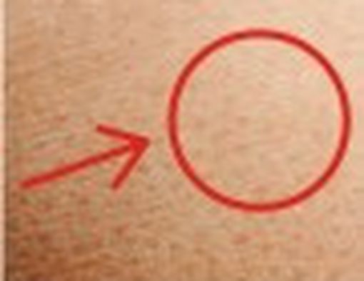 Kulit Kering, Salah Satu Ciri Penuaan Dini?