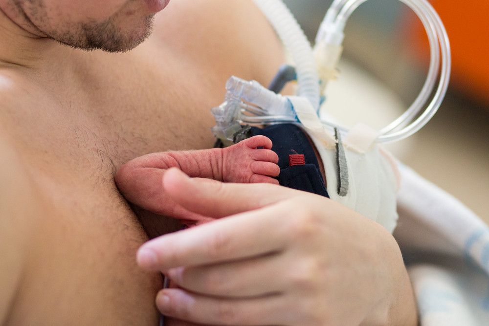 Metode Kanguru, Cara Merawat Bayi Prematur Tanpa Inkubator