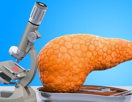 Mengenal Terapi Enzim untuk Pengobatan Kanker Pankreas