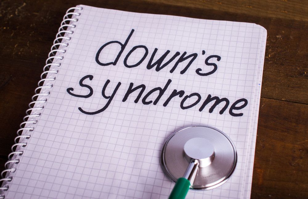 Komplikasi yang Sering Terjadi pada Anak Down Syndrome