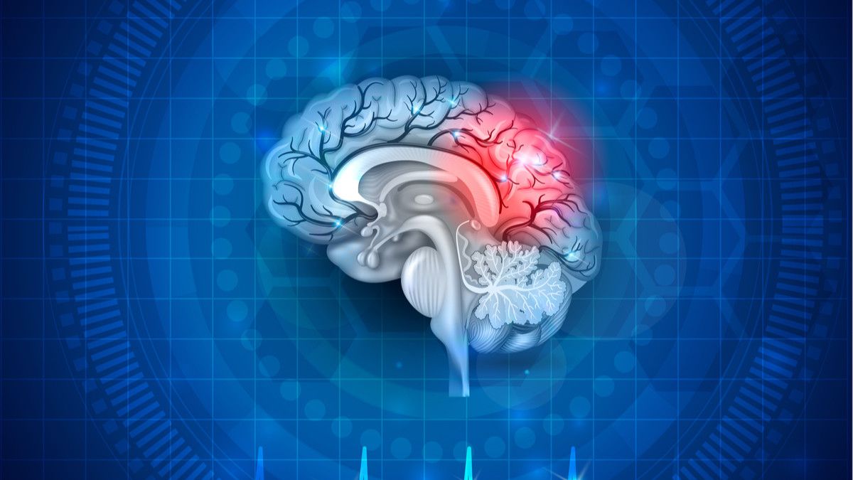 Cegah Stroke dengan 9 Cara Mudah Ini