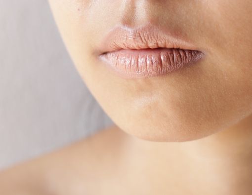 Penyebab Kulit di Sekitar Bibir Kering dan Cara Mengatasinya