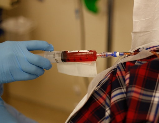 Selain Kanker, Penyakit Ini Bisa Diobati dengan Kemoterapi