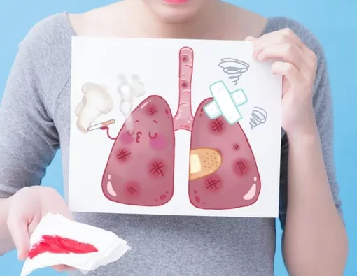 Daftar Makanan yang Dilarang untuk Penderita Paru-Paru Basah