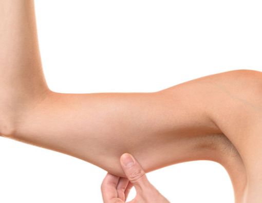 Cara Atasi Kulit Kendur Akibat Penurunan Berat Badan