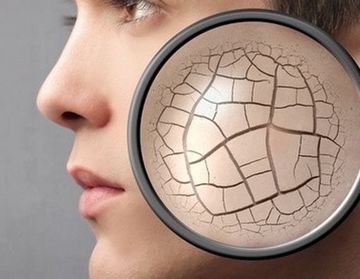 Cara Mengatasi Kulit Kering 