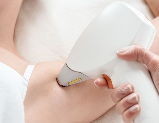 Perbandingan Efektivitas Terapi Penghilang Bulu Elektrolisis dan Laser