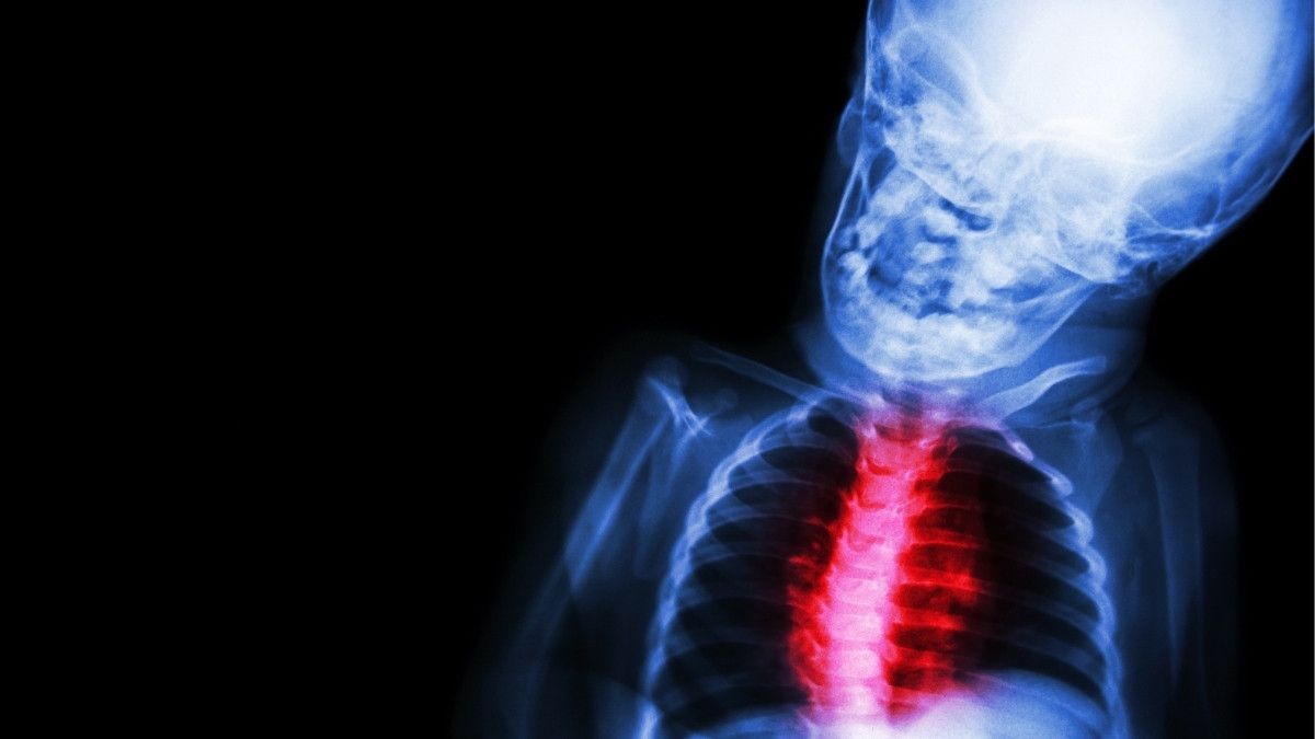 Faktor Penyebab Penyakit Jantung Bawaan pada Janin