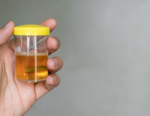 Kencing Berbusa, Pertanda Apa?