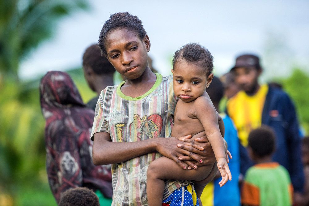 Kenali Gejala Campak yang Kini Mewabah di Asmat