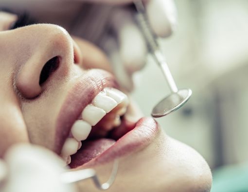 Pengobatan Meth Mouth, Gigi Busuk akibat Narkoba