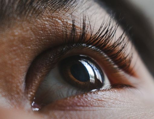 Cara Atasi Kelopak Mata yang Kering