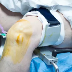 Mengenal Tugas Dokter Spesialis Ortopedi dan Tanggung Jawabnya