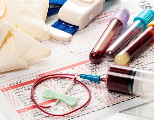 8 Tanda Gangguan Darah yang Belum Anda Ketahui