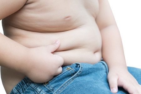 Cara Mencegah Anak Terlalu Gendut