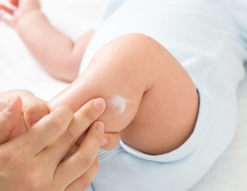 Skincare untuk Bayi, Apakah Benar Diperlukan?