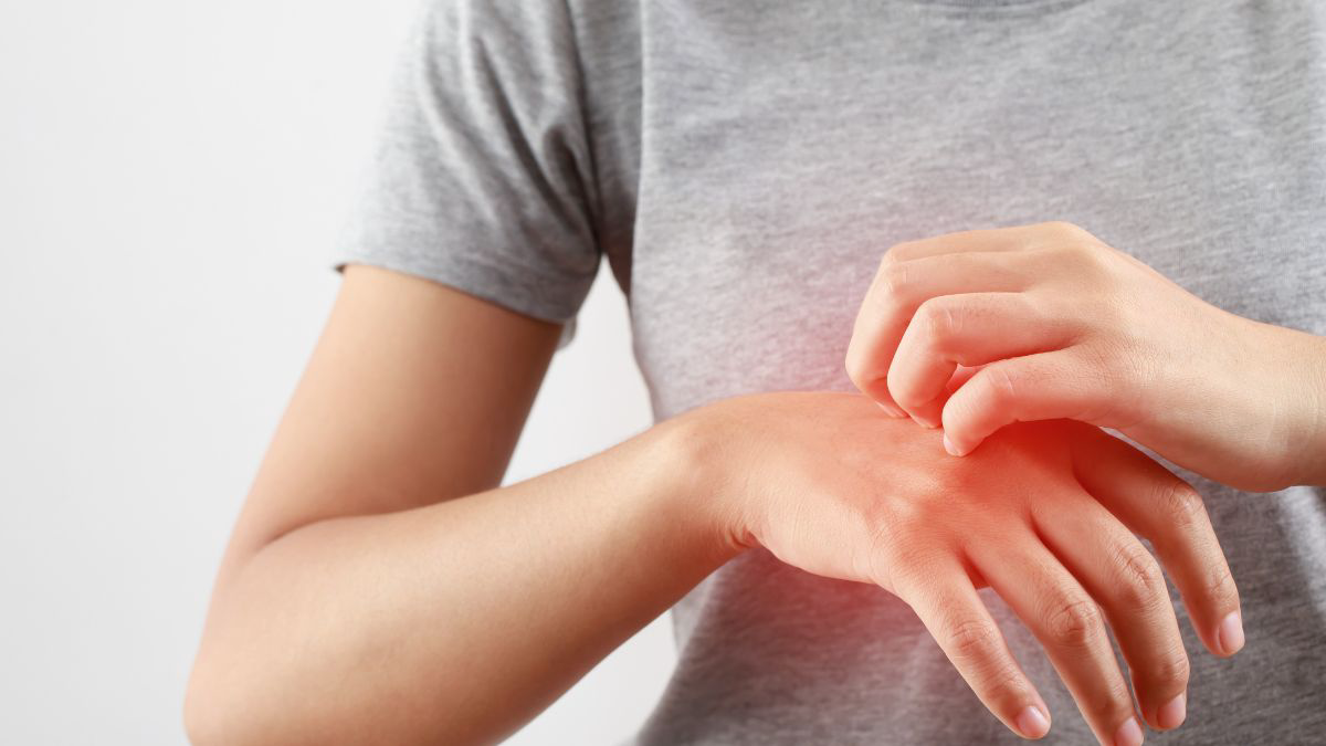 Cyproheptadine - Manfaat, Dosis, dan Efek Samping - KlikDokter