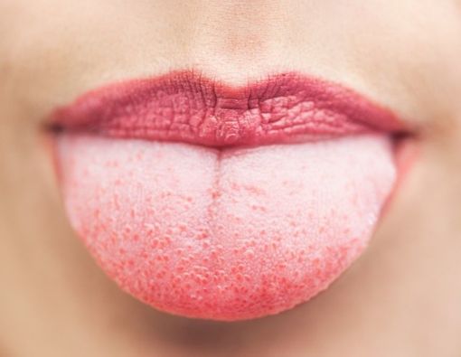 Fakta Medis Menarik Lidah Ketika Tidak Sadarkan Diri