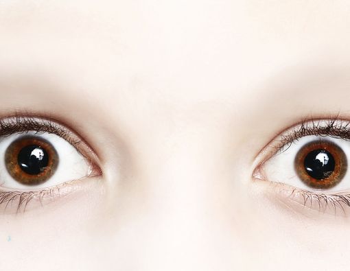 Bisakah Cacar Monyet Menginfeksi Mata?