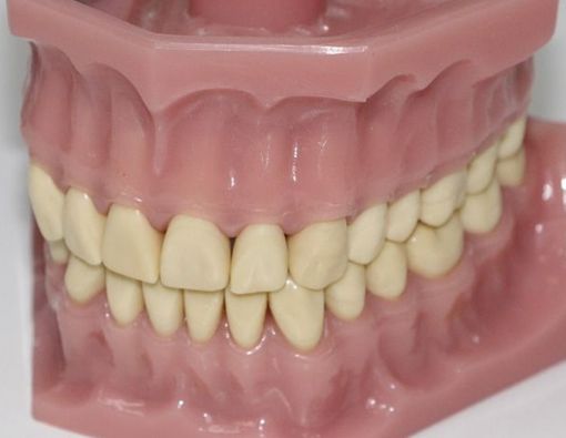 Penyebab Gigi Berwarna Abu-abu