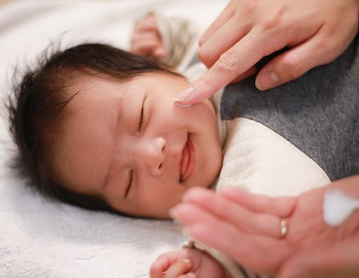 Muncul Ruam Setelah Bayi Minum Susu, Bagaimana Mengatasinya?