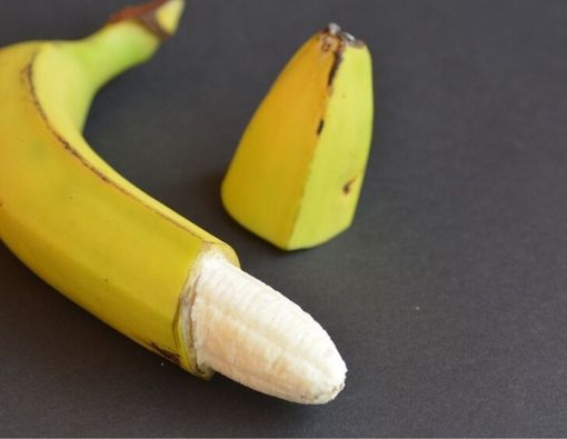 Bernanah hingga Lama Kering, Ini Cara Hindari Infeksi Setelah Sunat