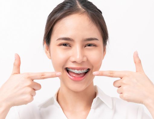 Panduan untuk Anda yang Pakai Kawat Gigi