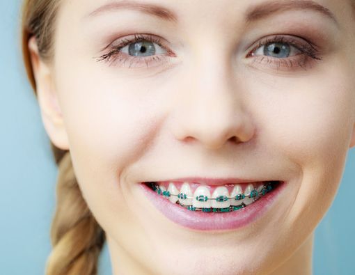 6 Tips Mengatasi Sariawan yang Muncul karena Behel