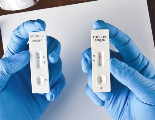 Perlu Tahu, Ini Penyebab Hasil Tes COVID-19 Salah