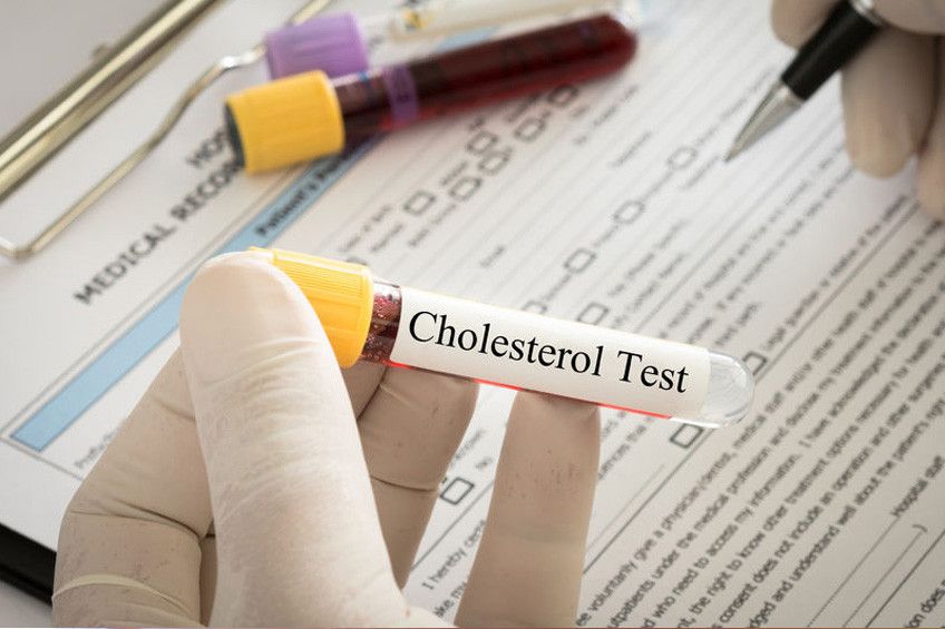 Kolesterol Baik Terlalu Tinggi Justru Berbahaya?