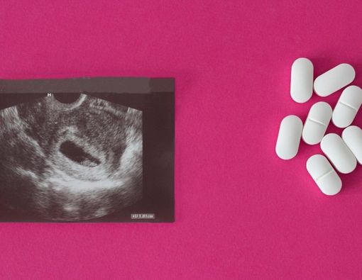 Efek Buruk Aborsi Bagi Kesehatan Mental Wanita