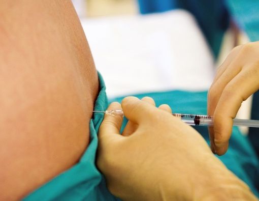 Mengenal Jenis Spinal Injection dan Efek Sampingnya