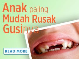 Anak Paling Mudah Rusak Gusinya