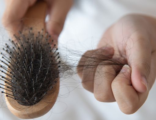 Temukan Kaitan antara Ketombe dan Rambut Rontok di Sini