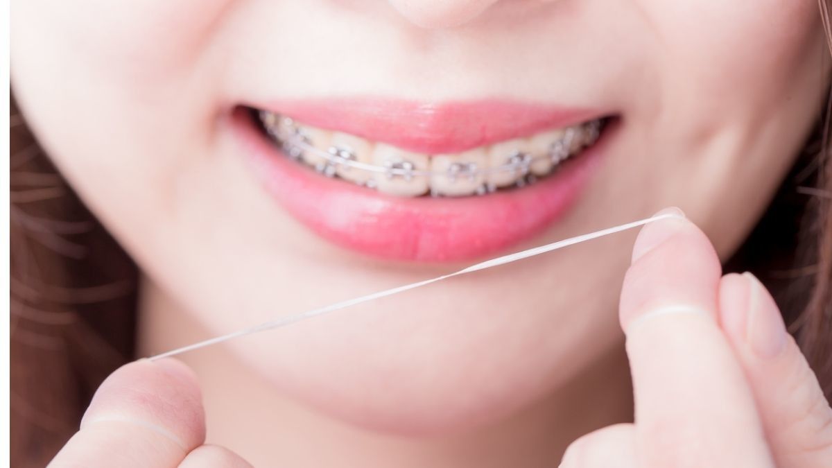 Cara Flossing Gigi yang Benar untuk Pengguna Behel