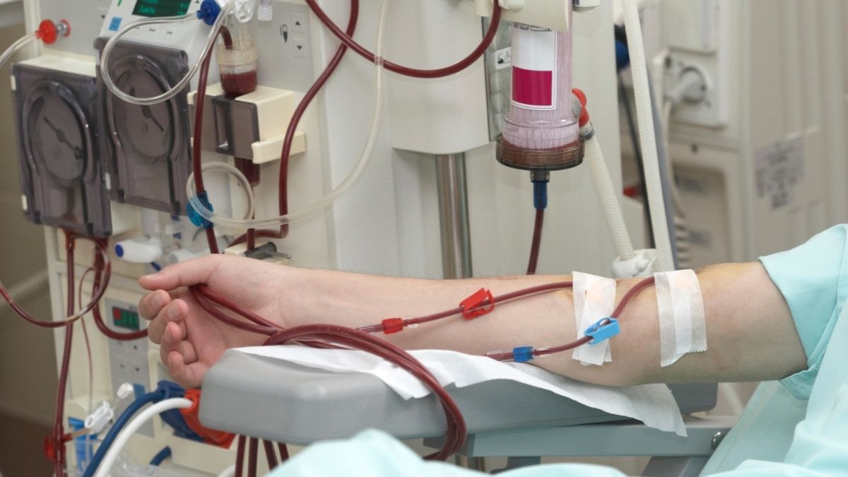 Mengenal Cara Kerja Mesin Cuci Darah, Hemodialisis