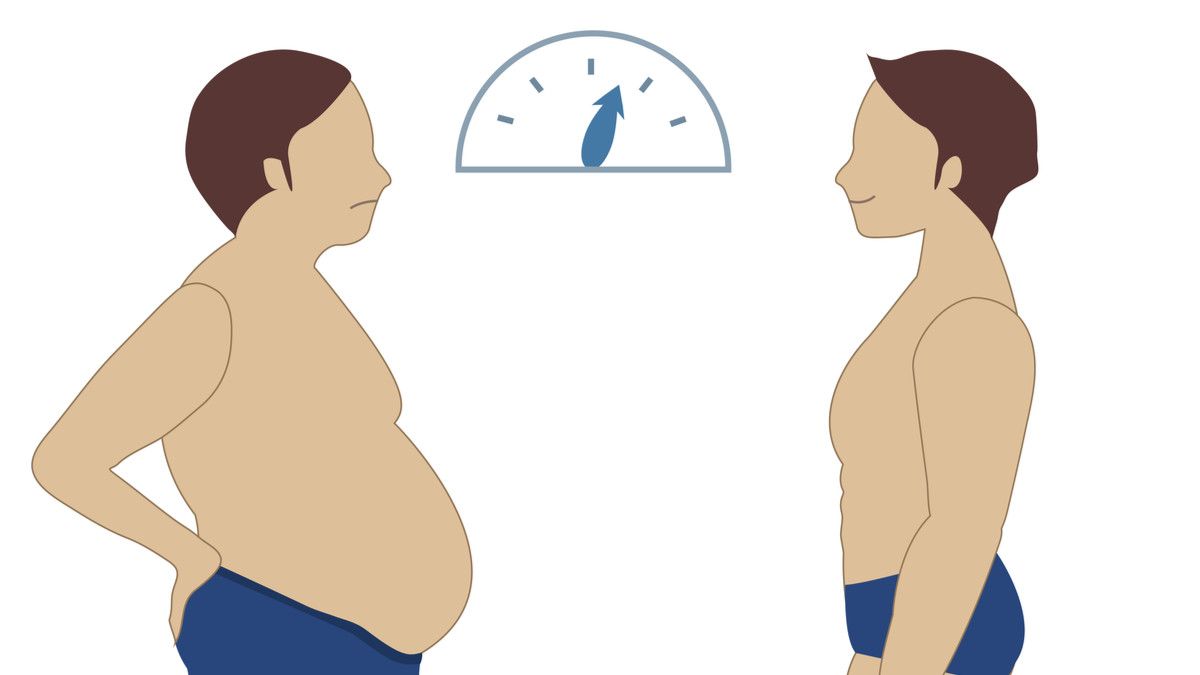 Penurunan Berat Badan Terlalu Cepat Picu Pembentukan Batu Empedu?