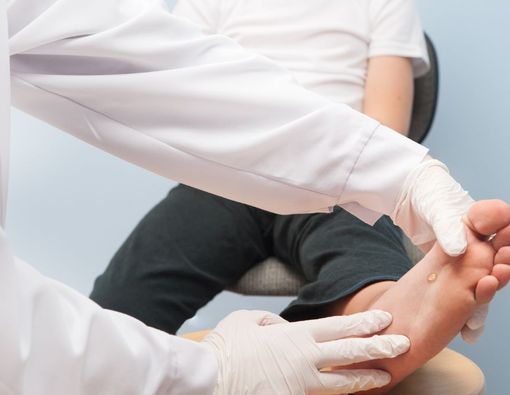 5 Ciri-Ciri Kutil di Kulit yang Perlu Diketahui