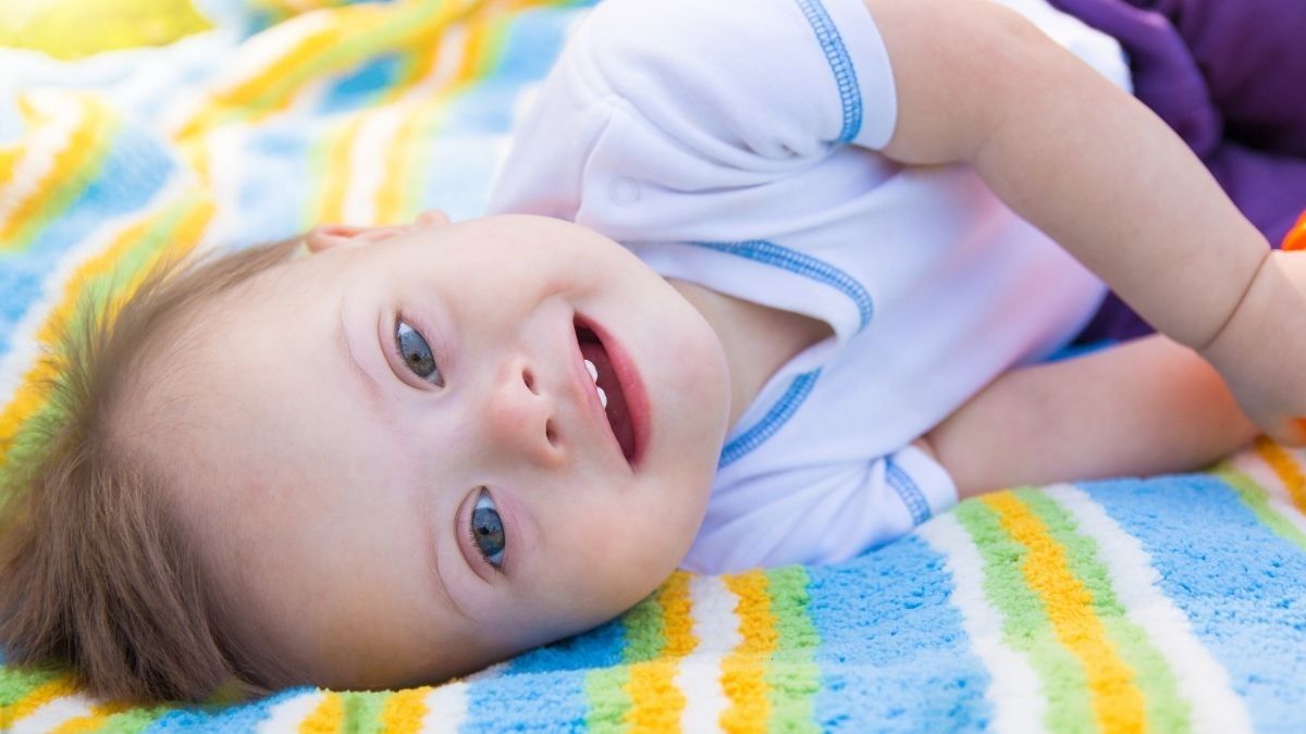 Penyebab Rendahnya Harapan Hidup Anak Down Syndrome 