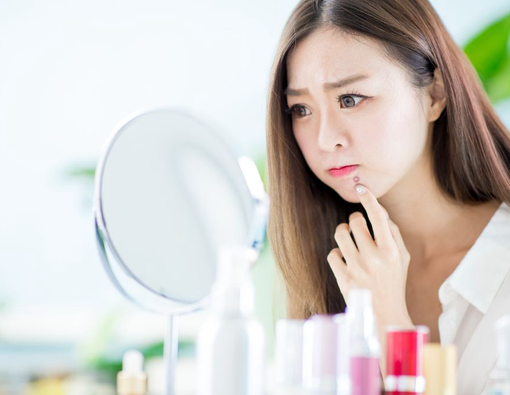 Cara Efektif Menghilangkan Jerawat di Dagu