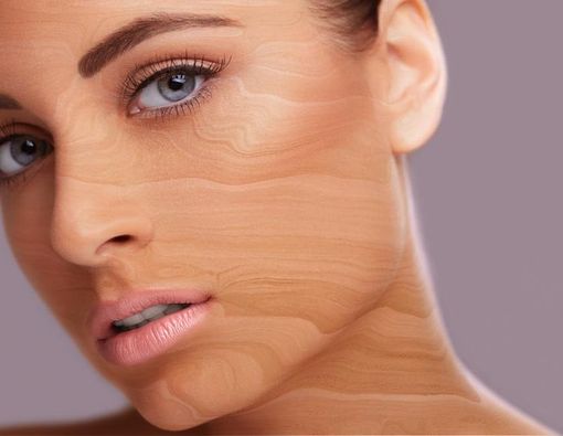 Skleroderma, Ketika Kulit Mengeras seperti Kayu