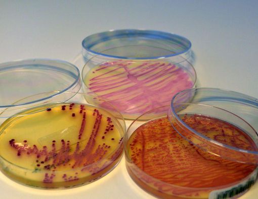 Fenomena Superbug yang Harus Diwaspadai