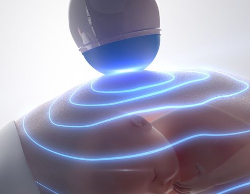 Ini Beda USG 2D, 3D, dan 4D yang Harus Diketahui Ibu Hamil