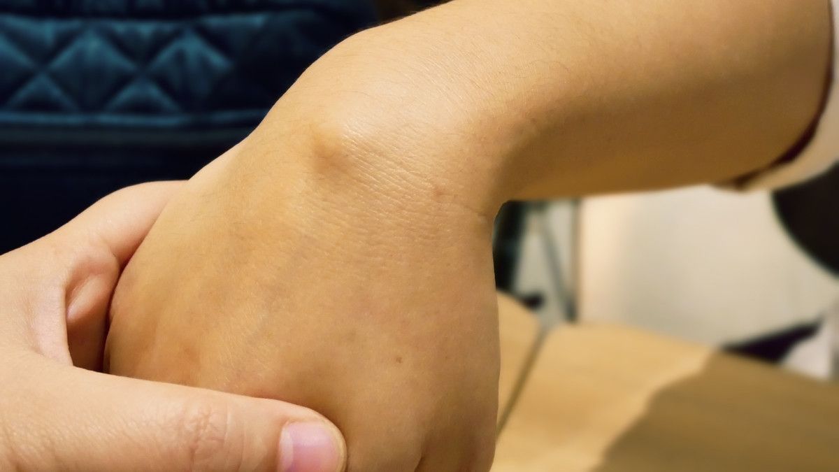 Kista Ganglion, Salah Satu Penyebab Benjolan di Tangan