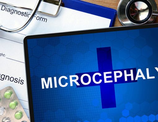 Mikrosefalia, Dampak Berbahaya Infeksi Zika