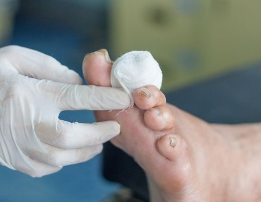 Gejala Diabetes Melitus