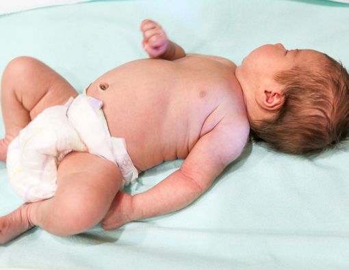 Tanda Serangan Epilepsi pada Bayi yang Wajib Diketahui