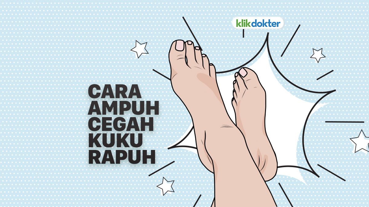 Kiat Ampuh Cegah Kuku Rapuh